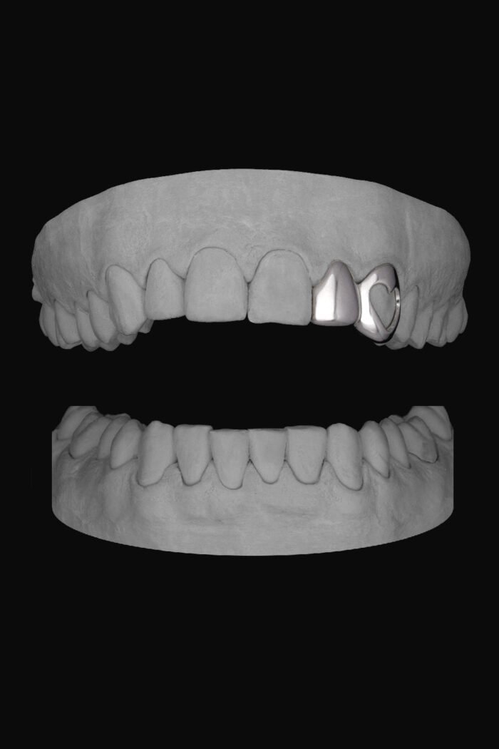 Lateral & Heart Canine - Image 1