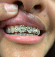 XL Bow Grillz - Image 2