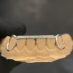 Grillz Diamond Bridge