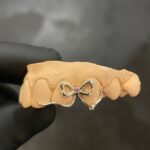 Sapphire Bow Grillz