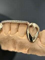 Lovers Bridge Grillz - Image 3