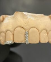 Diamond Spacer x Inlay Set - Image 2