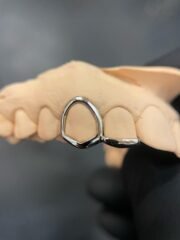 Grillz Window x Inlay