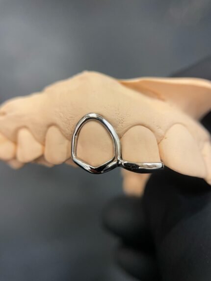 Grillz Window x Inlay