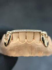 Lovers Bridge Grillz - Image 2