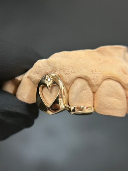 Star Set Heart Window x Inlay