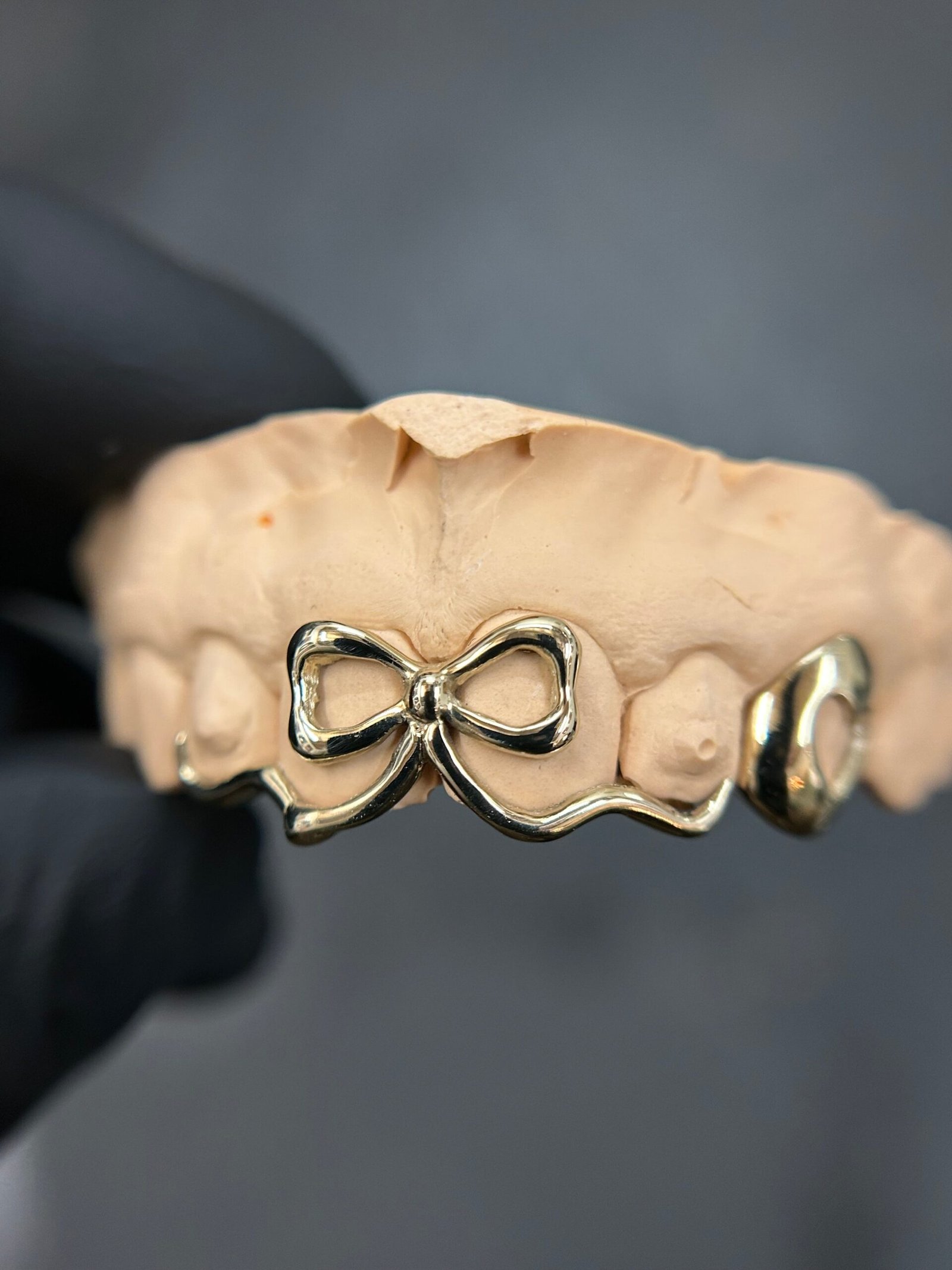 E3C47085-745D-4726-BDB7-BC06C081DA58.jpg XL Bow Grillz - Image 1