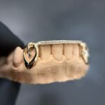 Lovers Bridge Grillz