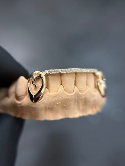 Lovers Bridge Grillz