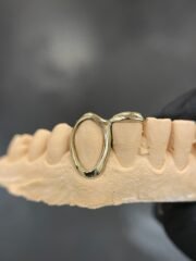 Grillz Window x Inlay - Image 2