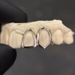twin grillz windows