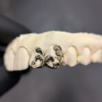 Filigree grillz Set
