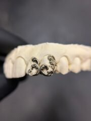 Filigree grillz Set
