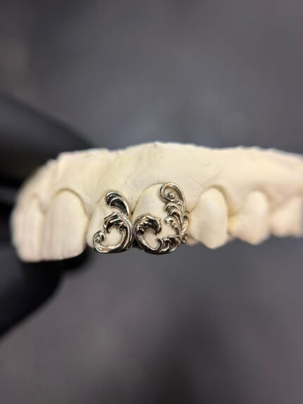Filigree grillz Set