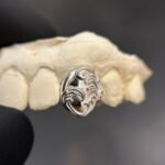 Full Filigree Cap Grillz
