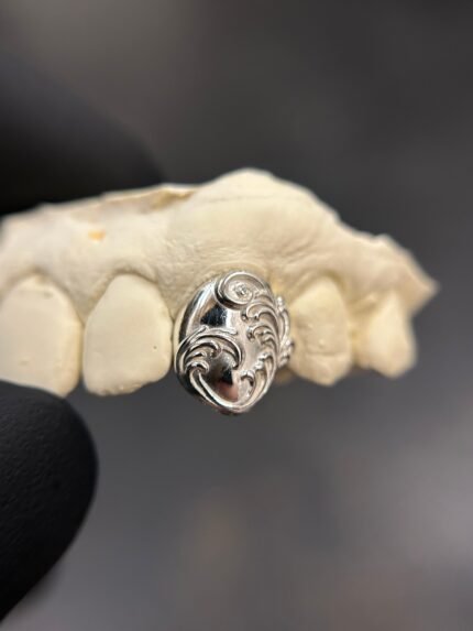Full Filigree Cap Grillz