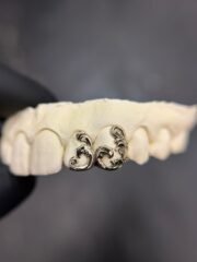 Filigree grillz Set - Image 2